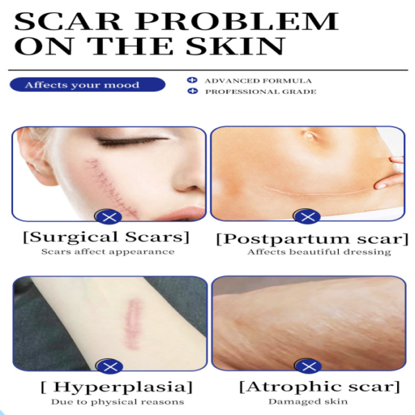 SILICONE SCAR CREAM - Image 7