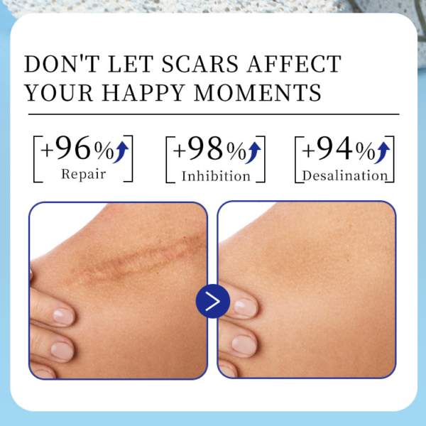 SILICONE SCAR CREAM - Image 10
