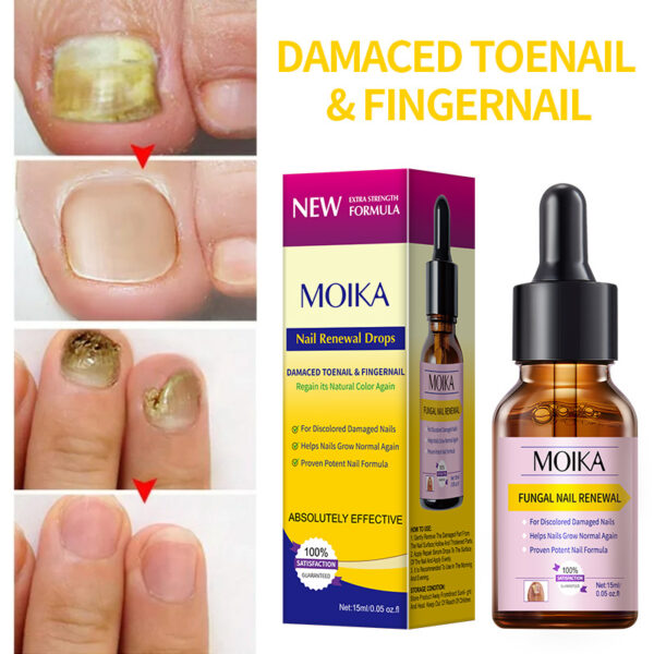 Nail Renewal Drops