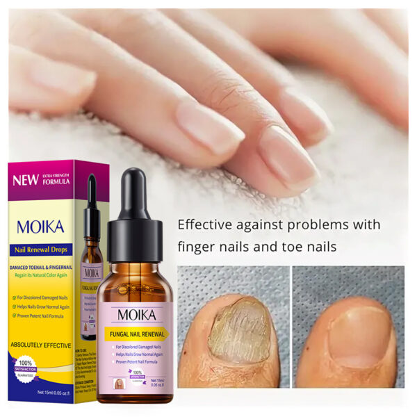 Nail Renewal Drops - Image 2