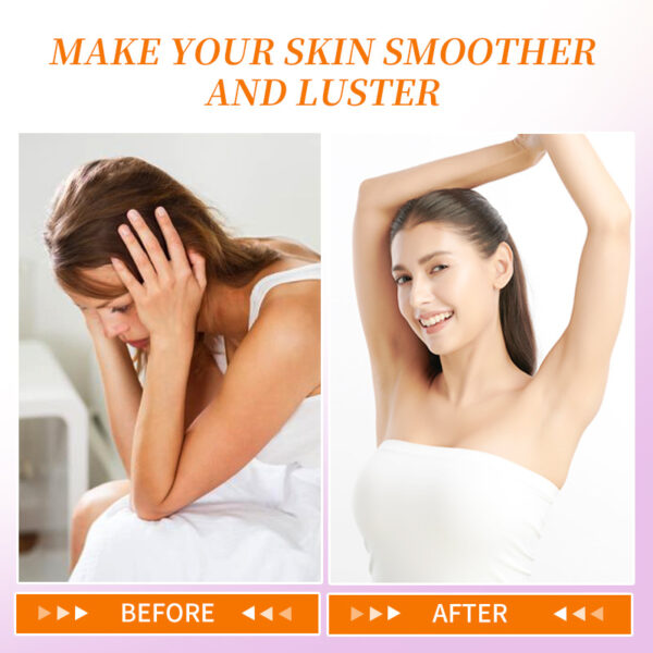 Dark spot Removal Cream - Image 10