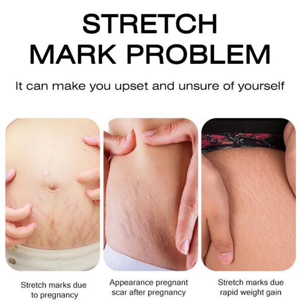 ANTIPREGNANCY WRINKLE CREAM - Image 2